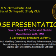 CASE PRESENTATION Dr. D. Class III 2 Jaw Procedure 2026.07