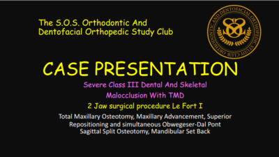 CASE PRESENTATION Dr. D. Class III 2 Jaw Procedure 2026.07