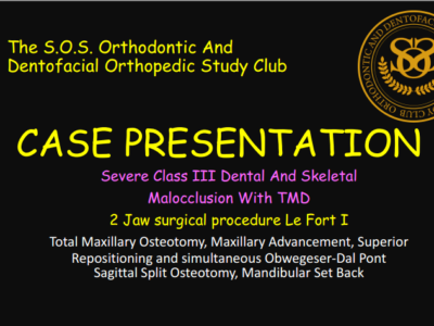 CASE PRESENTATION Dr. D. Class III 2 Jaw Procedure 2026.07
