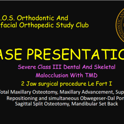 CASE PRESENTATION Dr. D. Class III 2 Jaw Procedure 2026.07