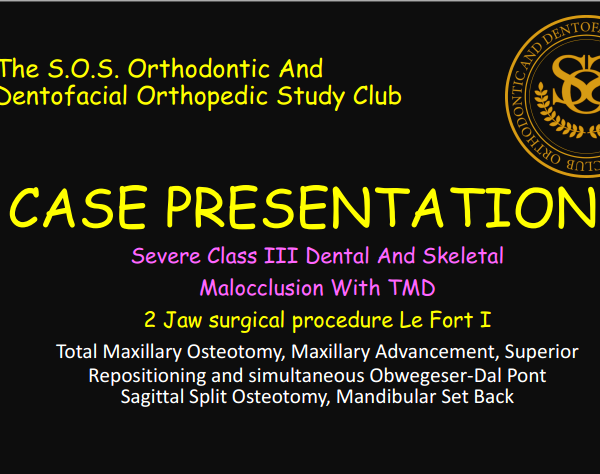 CASE PRESENTATION Dr. D. Class III 2 Jaw Procedure 2026.07