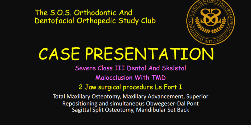 CASE PRESENTATION Dr. D. Class III 2 Jaw Procedure 2026.07