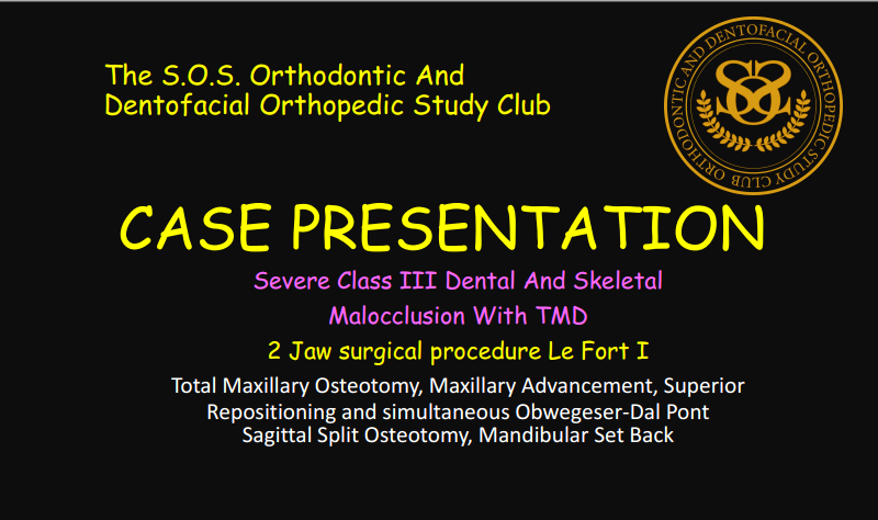 CASE PRESENTATION Dr. D. Class III 2 Jaw Procedure 2026.07